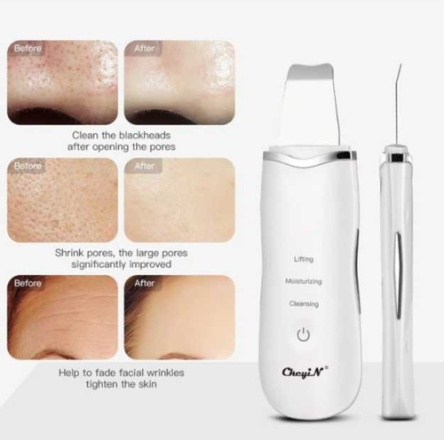 EMS RF Ultrasonic 4-in-1 Multifunctional Beauty Device