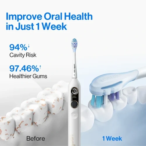 usmile Y10  Electric Toothbrush
